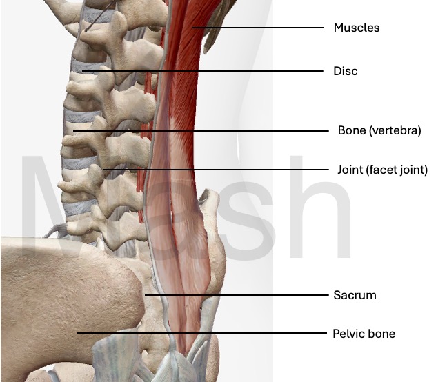 Figure for lower back pain