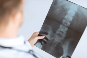 Accurate diagnosis of spinal problem